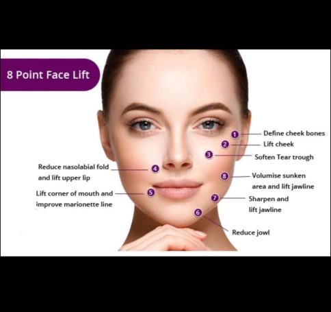 Diagram illustrating an 8 Point Face Lift with key benefits highlighted on a woman's face.