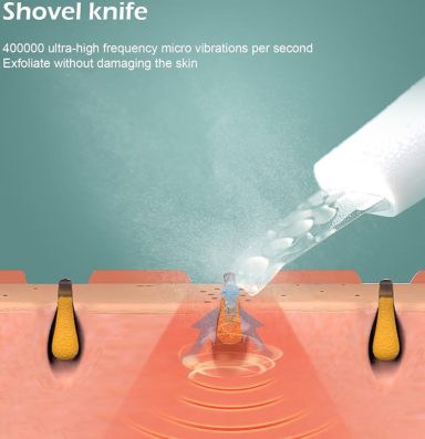 Illustration of a shovel knife using ultrasonic vibrations for skin treatment.