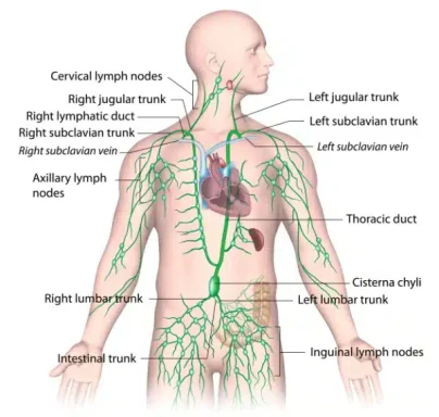 Diagram of the human lymphatic system showing major vessels and lymph nodes.